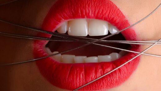 Naturally Plumped Lips: The Secret of the Sexy Pout without Lip Fillers