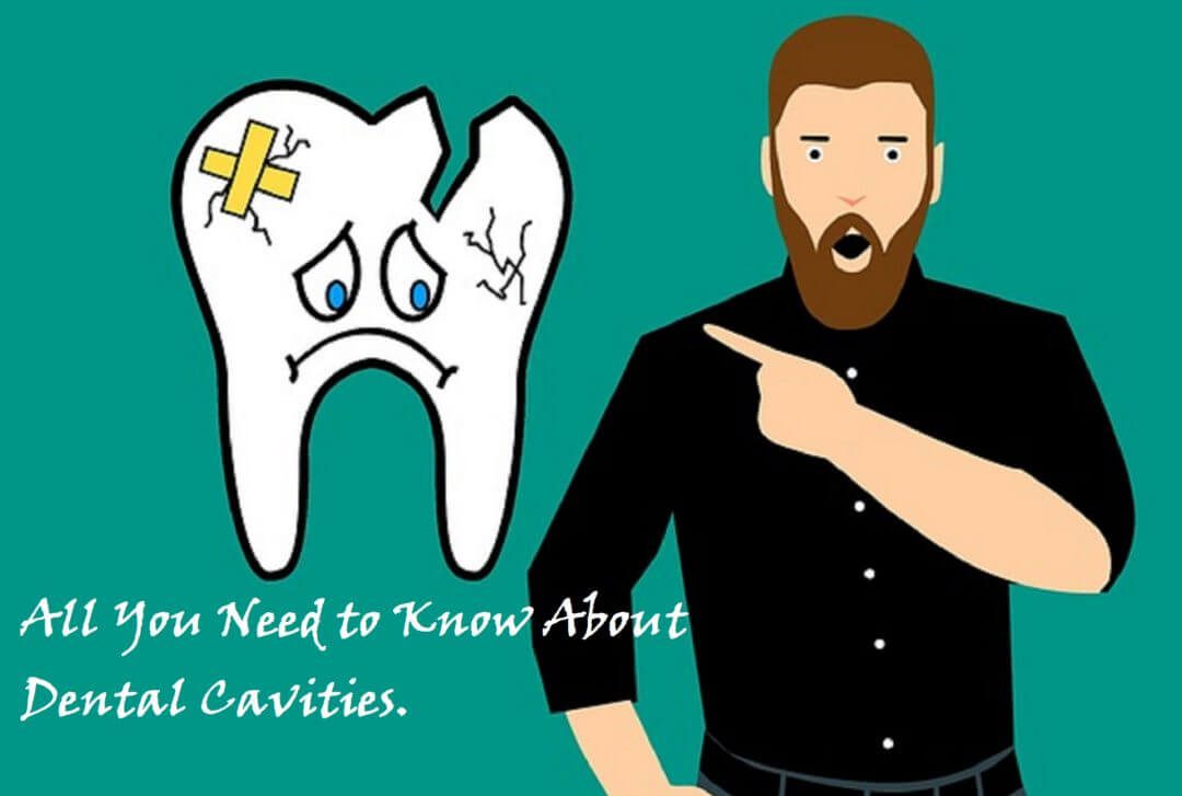 Everything You Need to Know About Dental Cavities.