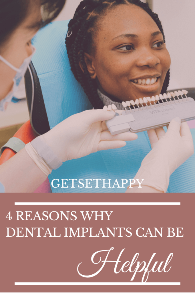 Top 4 Benefits of Dental Implants