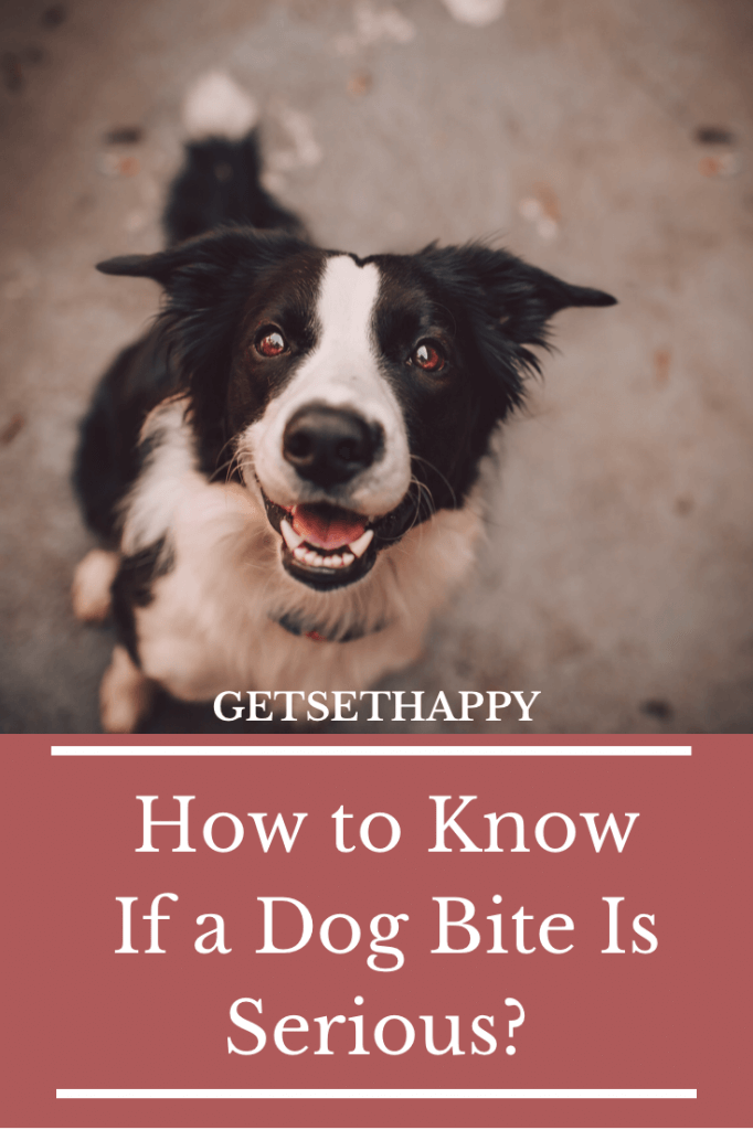 How to Know If a Dog Bite Is Serious?