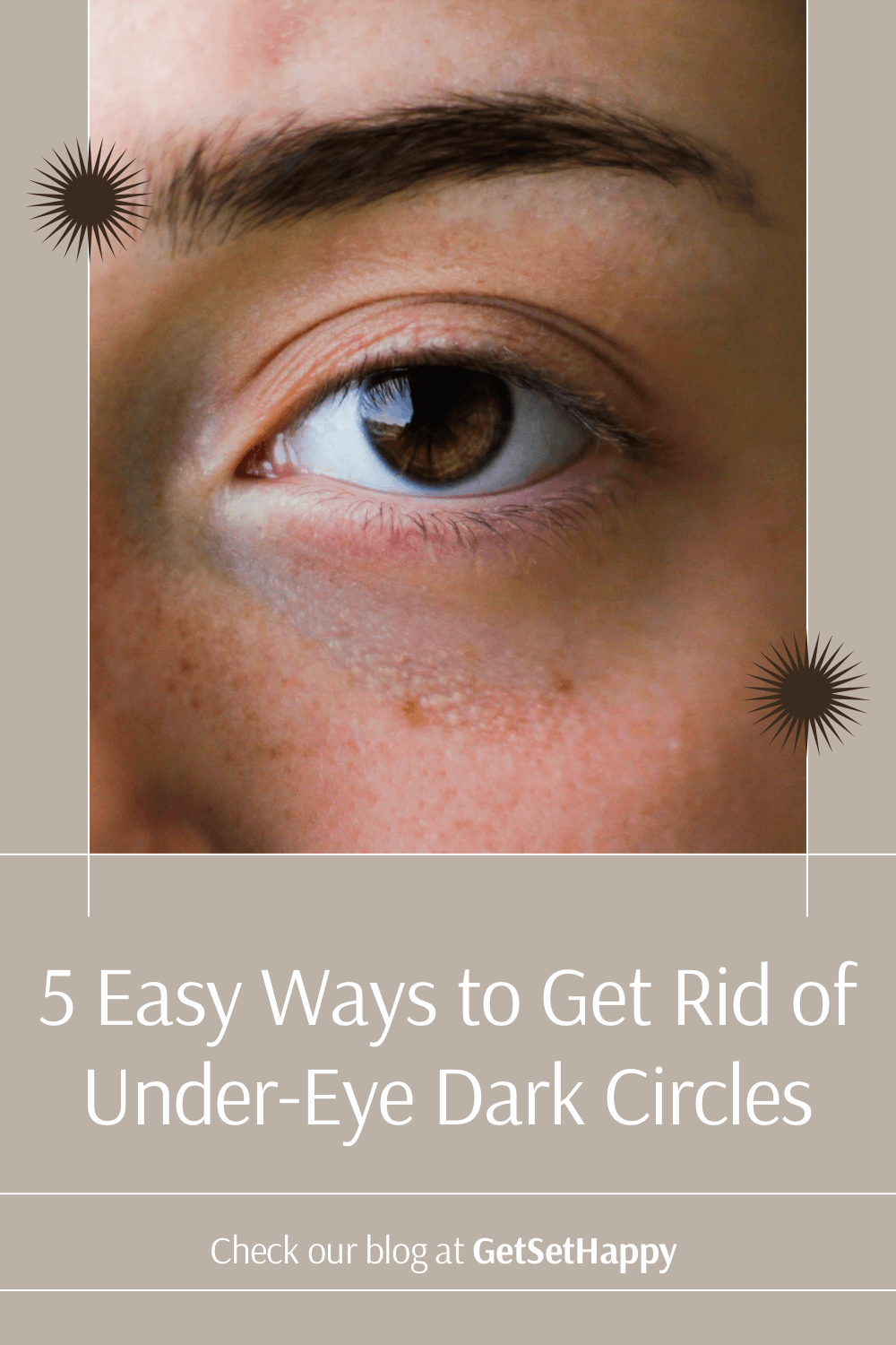 5 Easy Ways to Get Rid of Under-Eye Dark Circles | GetSetHappy